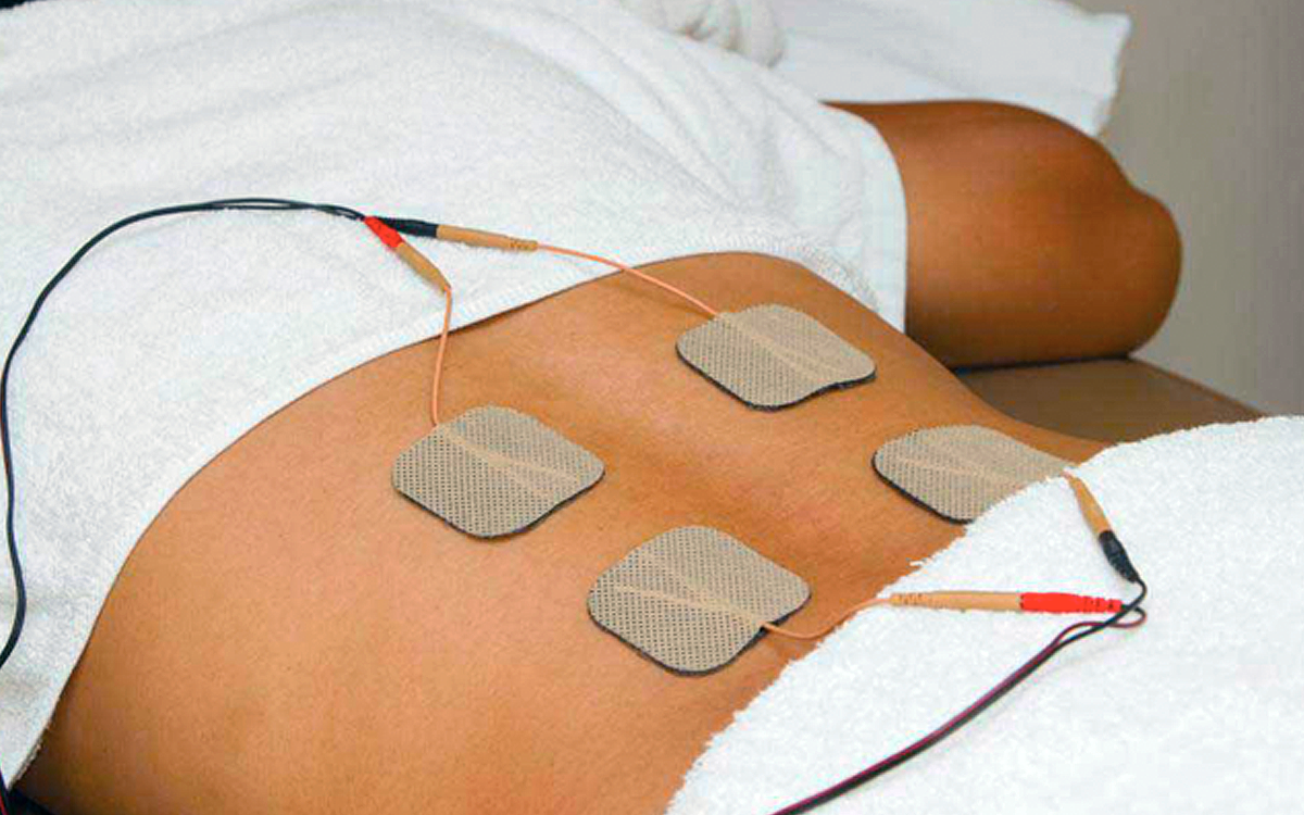 electronic_stimulation_therapy